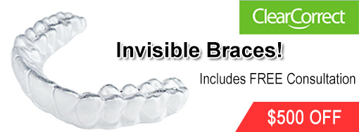 ClearCorrect Invisible Braces without the metal!