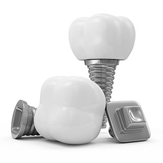 Dental Implants and Cosmetic Dentist near commerce