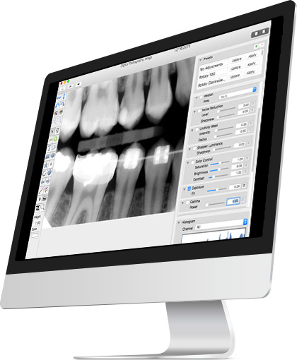 digital x-rays at our dental office