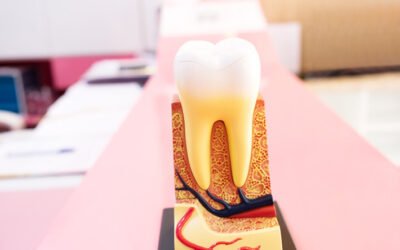 Cracking the Code to Tooth Decay