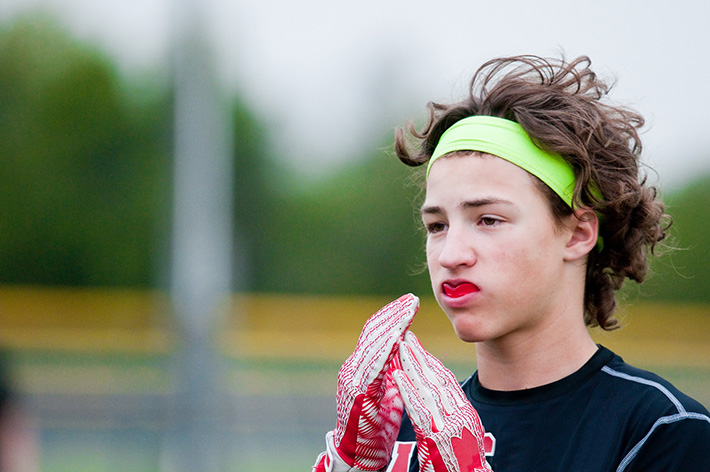 The Importance of Mouth Guards in Sports