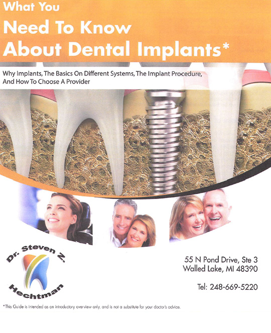 dental-implants-guide